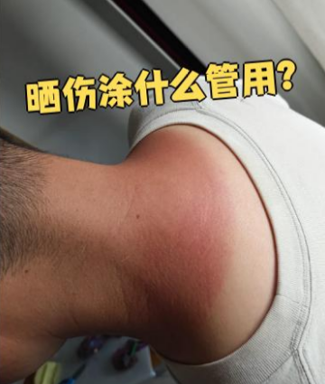 晒后泛红发烫?一杯温凉茶水,舒缓修护超实用-茶之家